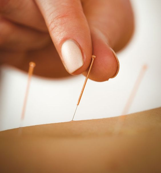 despre acupunctura